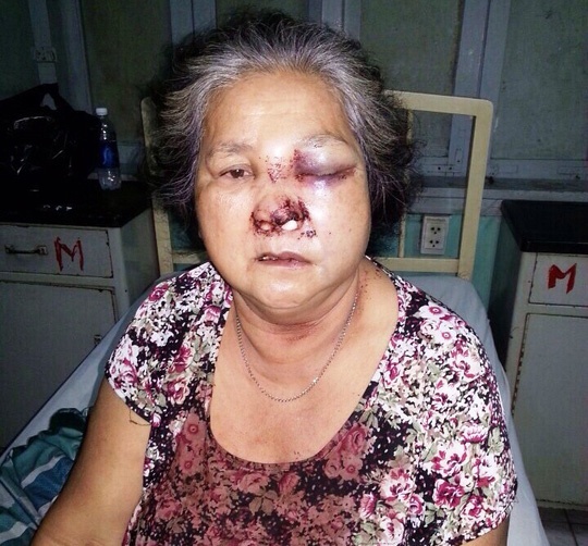 Cong an co so, anh o dau?: Hau qua dau long! hinh anh