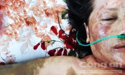 Thuê cháu tạt axit vào người tình ảnh 1 Thue chau tat axit vao nguoi tinh anh 1