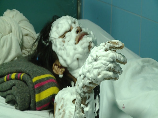 No bong bay chua Hidro anh 1