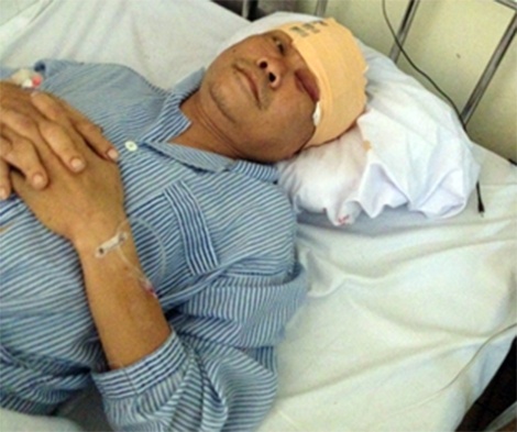 Chém trọng thương công an ảnh 1 Chem trong thuong cong an anh 1