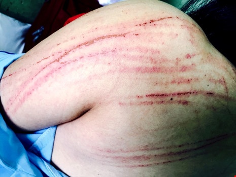 De nghi khoi to vu nu luat su bi danh tai toa hinh anh