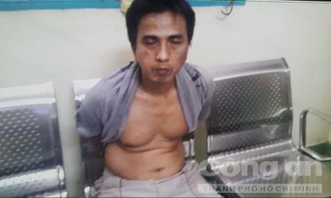 Hiep si phoi nhiem HIV anh 1