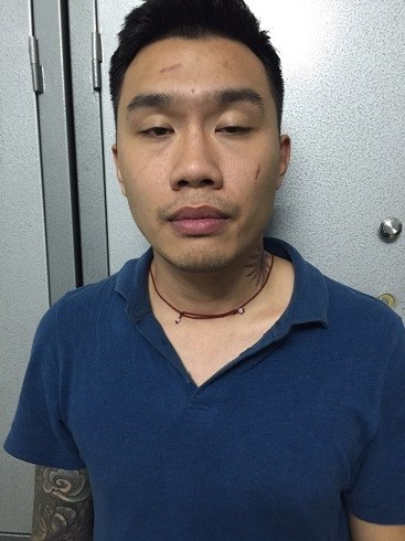 đe dọa cắt gân chân  ảnh 1 de doa cat gan chan anh 1