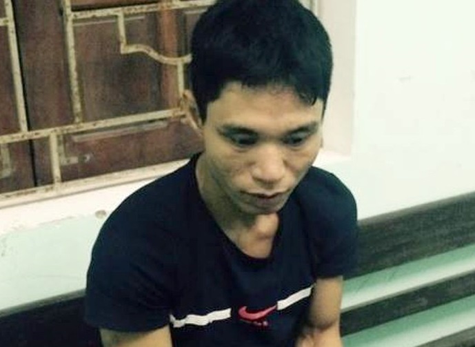 Bi bat som vi trom iPhone 6S co cai dinh vi hinh anh