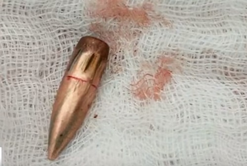 Hang tram ho dan o Vinh Phuc song trong bat an do 'dan lac' hinh anh