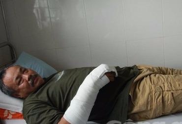 Ten trom dam chu nha nhieu nhat roi bo chay khi bi phat hien hinh anh