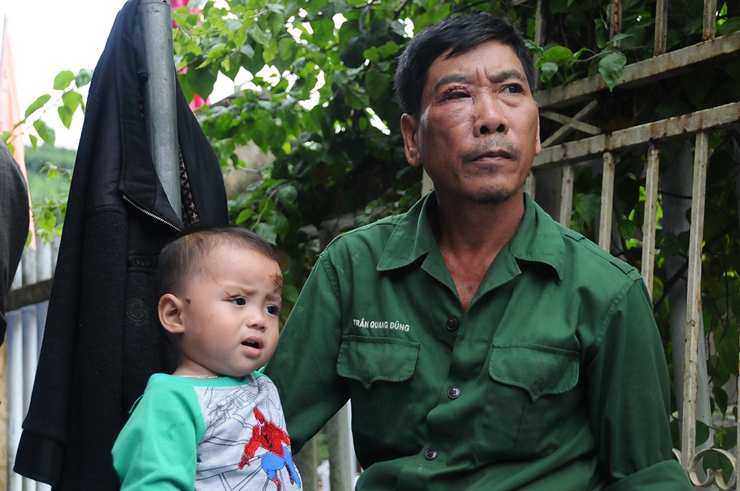 sat lo dat o Bac Tra My anh 1