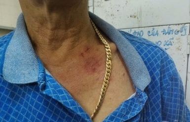 Hai ten cuop sa luoi vi giat day chuyen vang khong dut hinh anh