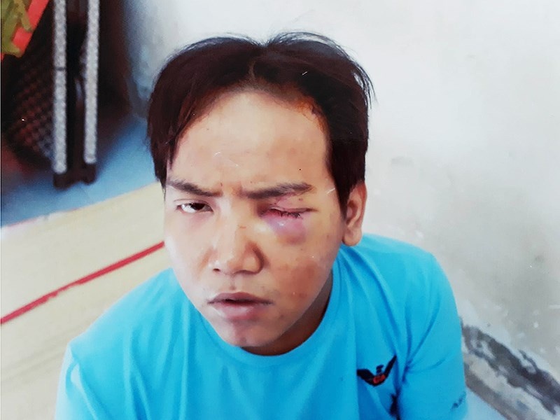 Loi khai cua bao ve dan pho sat hai be trai 6 tuoi o Sai Gon hinh anh