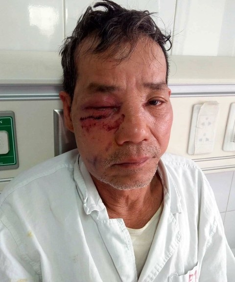 Lâm tặc phục kích ném đá kiểm lâm ảnh 1 Lam tac phuc kich nem da kiem lam anh 1