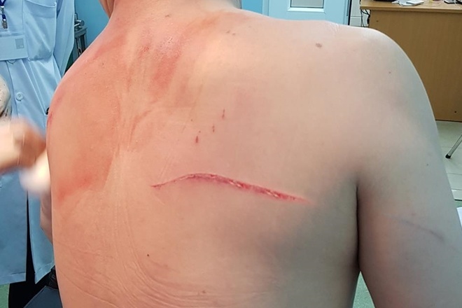 thue giang ho chem chong anh 2