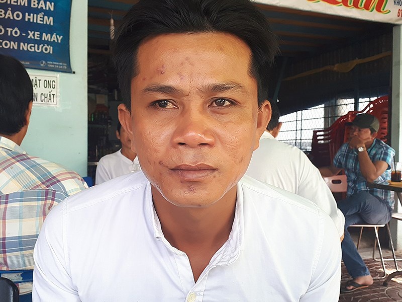 vết thương làm khó cơ quan điều tra ảnh 1 vet thuong lam kho co quan dieu tra anh 1