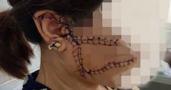 chồng rạch mặt vợ ở Bắc Giang ảnh 1 chong rach mat vo o Bac Giang anh 1