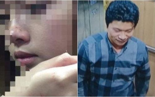 Vu sam so bi phat 200.000 dong: Nu sinh quyet kien den cung hinh anh