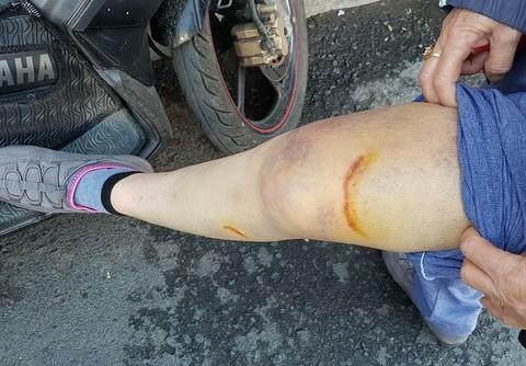 Gã người nước ngoài đi ôtô cướp tài sản ảnh 2 Ga nguoi nuoc ngoai di oto cuop tai san anh 2