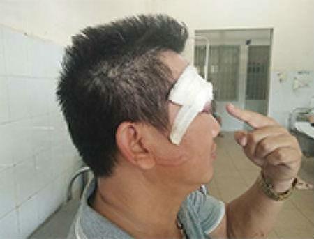 Bi truy sat bang sung khi hen gap nguoi den mua dat hinh anh
