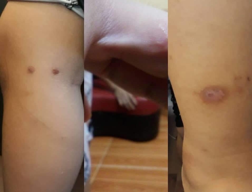 Bé trai 12 tuổi nghi bị bố và mẹ kế bạo hành  ảnh 1 Be trai 12 tuoi nghi bi bo va me ke bao hanh anh 1
