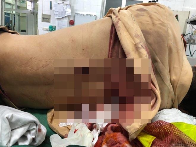 Nguoi pham luat bat ngo dam trung uy CSGT tu phia sau hinh anh