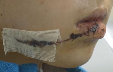 Nu cong nhan bi ban trai rach mat hinh anh