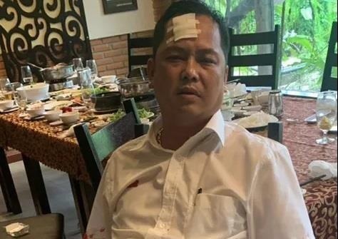 Vu giang ho vay xe cho cong an: Nguoi bi danh 'phan phao' hinh anh