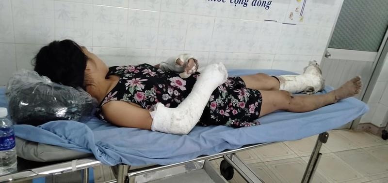 Thai phụ bị chồng đánh vỡ nền sọ  ảnh 1 Thai phu bi chong danh vo nen so anh 1