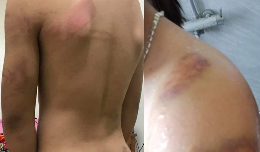 Ngáo đá ảnh 1 Ngao da anh 1