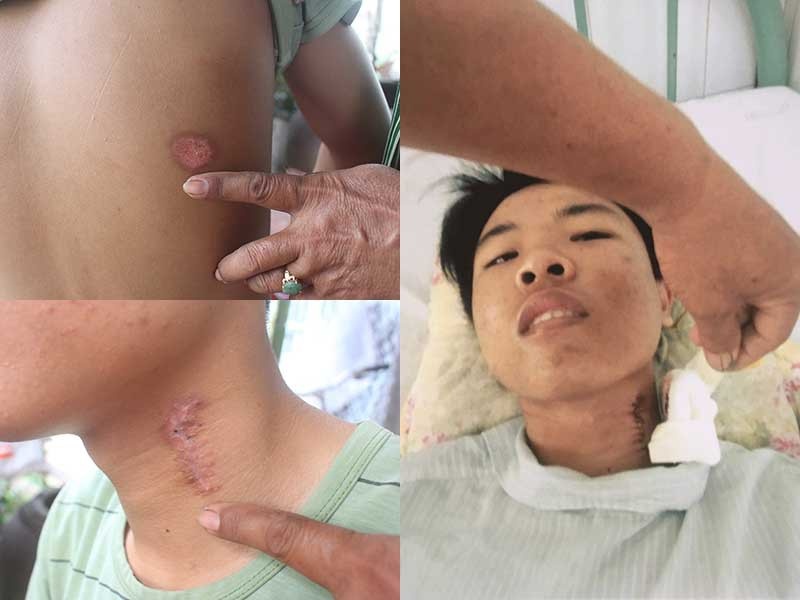 CSGT bắn người gây thương tích ảnh 1 CSGT ban nguoi gay thuong tich anh 1