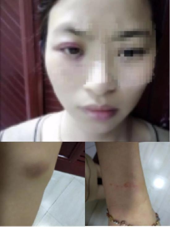 Chong bao hanh anh 1