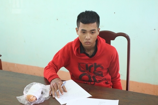 Nguoi yeu mat xe anh 1