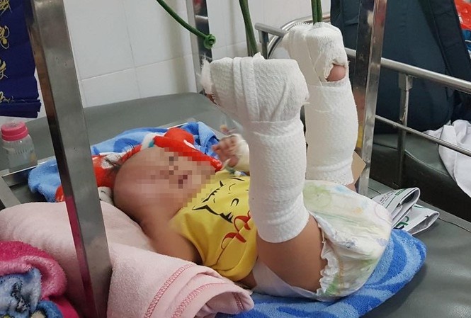 Be trai 4 thang tuoi nghi bi cha danh xuat huyet nao hinh anh