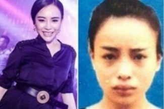 Phau thuat thanh hot girl, hot boy tron na van khong thoat hinh anh