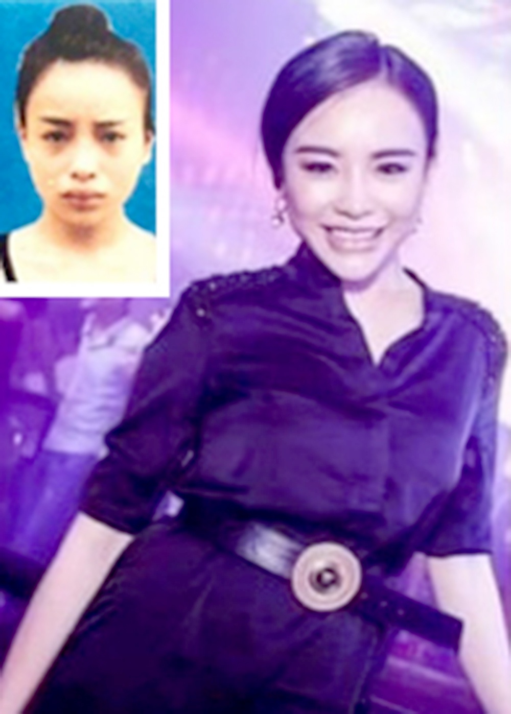 phau thuat tron truy na anh 1