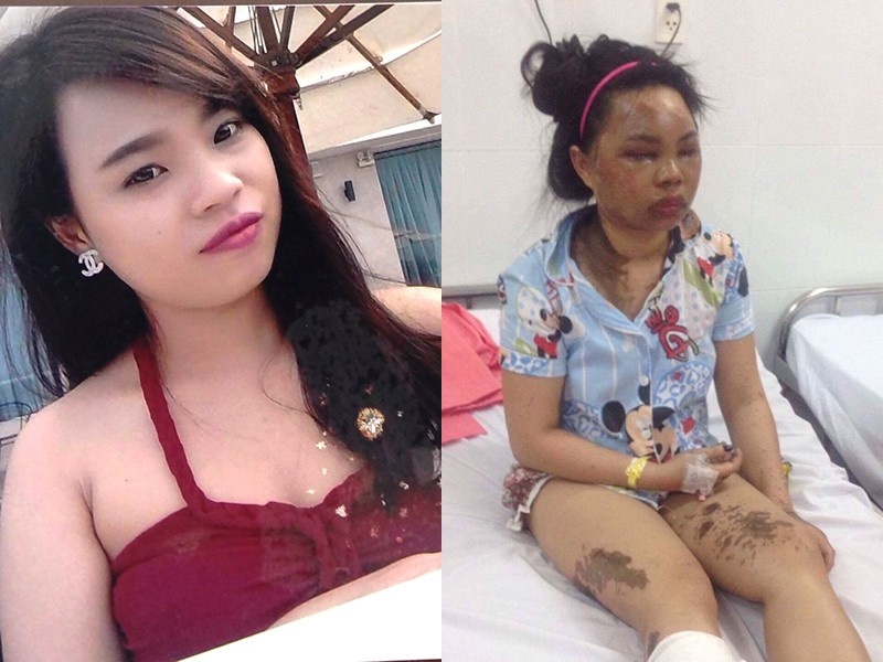 Noi dau cua ca gia dinh bi tat axit hinh anh