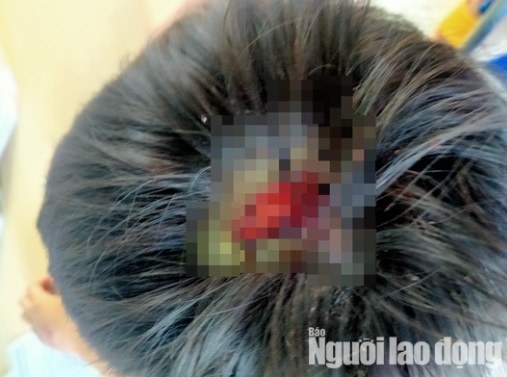 cha bao hanh con anh 1