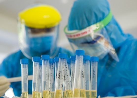 Cach ly 12 can bo huyen o Ba Ria - Vung Tau hinh anh