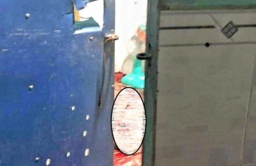 Nguoi dan ong tu vong voi nhieu vet cat tren co hinh anh