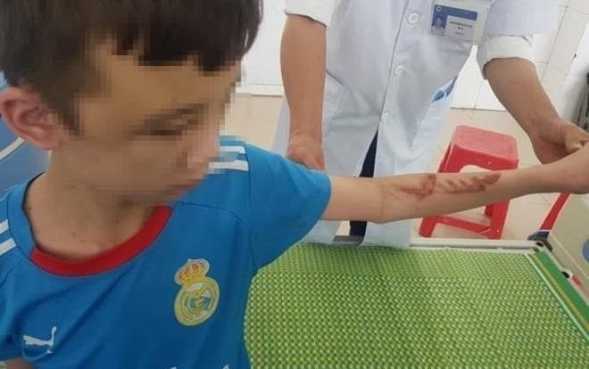 tra tan nhan vien anh 2