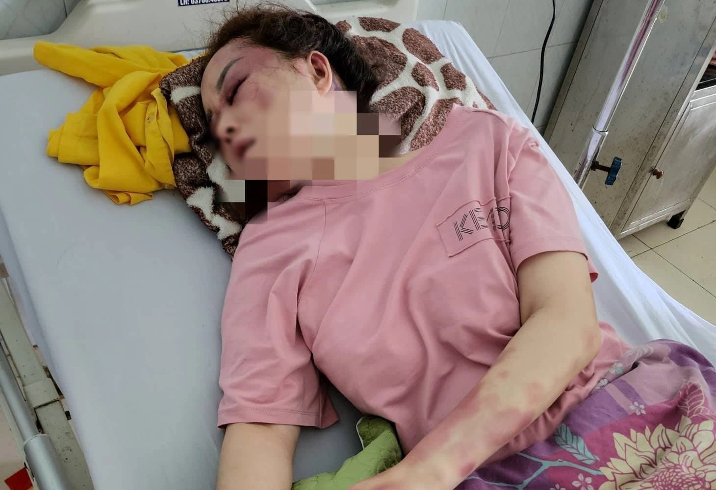 Co gai to bi ban trai danh, lot quan ao vi song ca voi nguoi khac hinh anh
