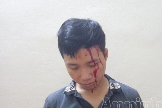 Ru nguoi yeu mua tiet lon dung man kich bi bat coc de tong tien me de hinh anh