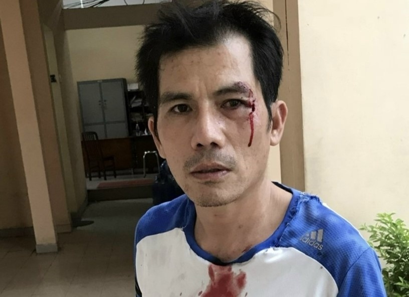 đánh hàng xóm ảnh 1 danh hang xom anh 1