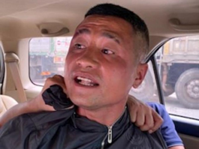 Nguoi dan ong cat giau dan sung ngan de phong than hinh anh