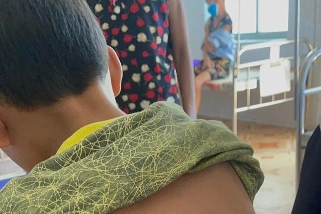 Dung xang va rom dot chan con trai, nguoi cha bi xu phat the nao? hinh anh