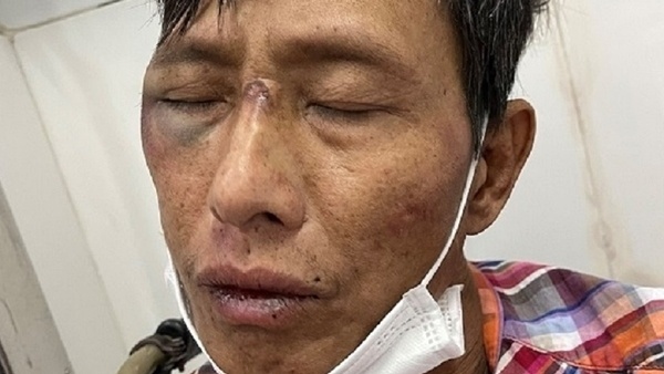 Bi vay bat sau khi gay an, nguoi dan ong vac riu chem 2 cong an hinh anh