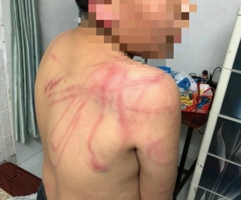 Bao hanh con ruot, cha doi dien hinh phat nao? hinh anh