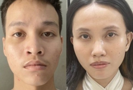 Lat tay chieu tro gia gai moc vi khach massage hinh anh