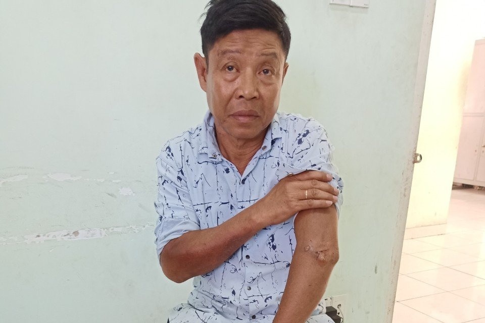 Gian vo, chong dot xe may lam chay nha tro o Binh Duong hinh anh