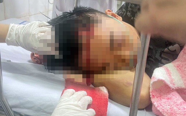 Tam giu 14 nguoi vu 2 nhom trai lang o Hai Phong hon chien hinh anh