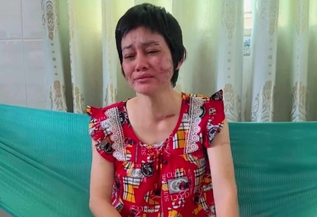 Cong an vao cuoc vu nguoi phu nu bau 7 thang bi thuong tich chang chit hinh anh