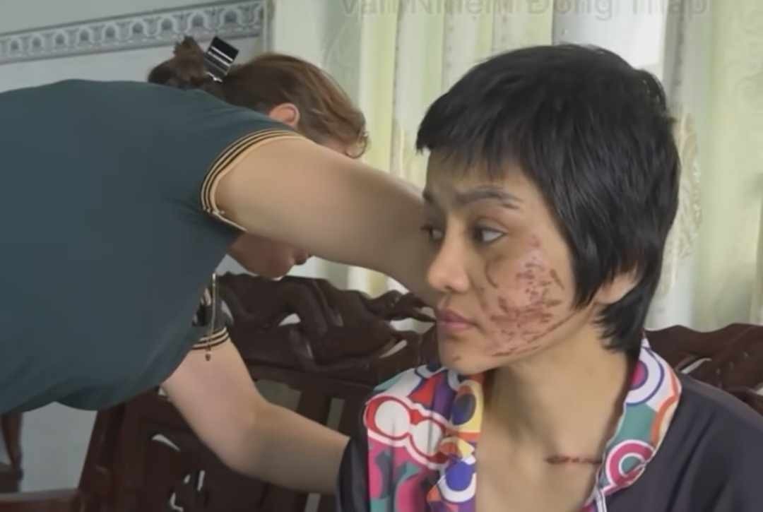 chong bao hanh anh 1