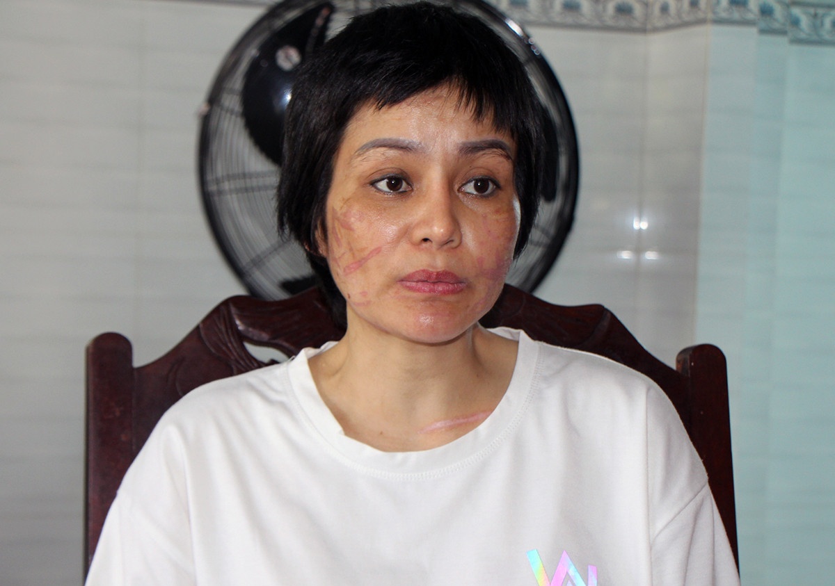 Chong bao hanh nguoi phu nu mang bau 7 thang hinh anh